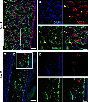 CD51 labels periosteal injury-responsive osteoprogenitors